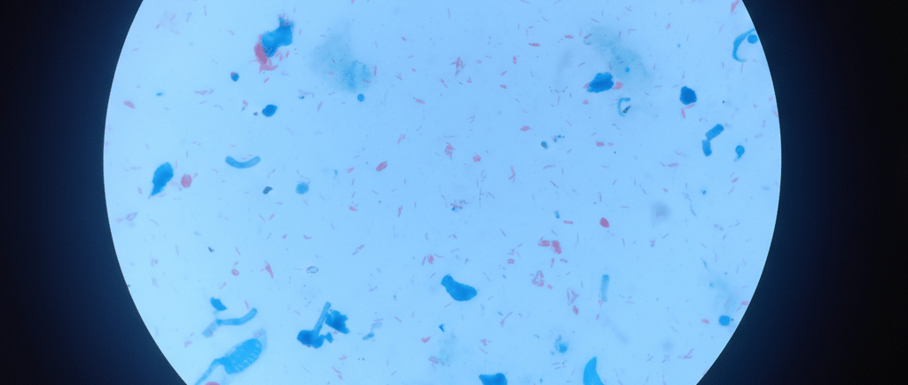 Imagem do Artigo sobre Hanseníase