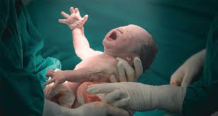 even if a C-section isn’t your first choice, preparing for it is essential