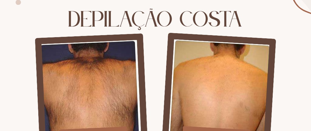 Depilação Masculina costas