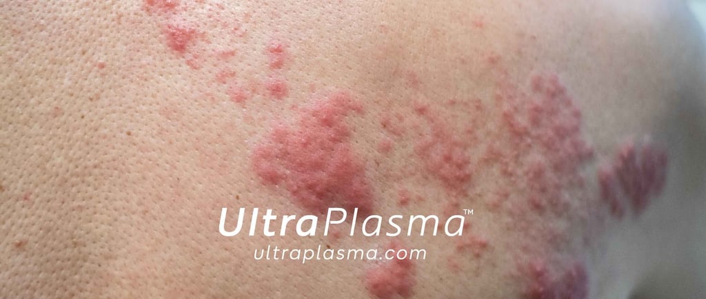 _ultra_plasma_ultra_plazma