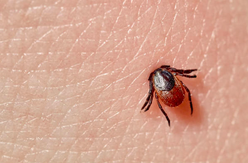 Piqures punaises de lit