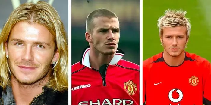 david beckham hair transplant
