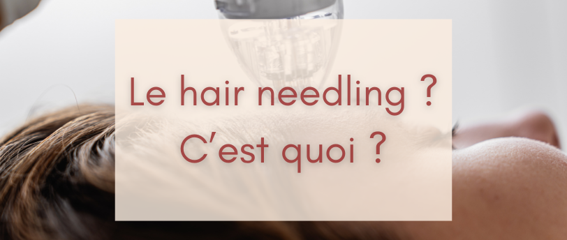 Le hair needling ? C'est quoi ?