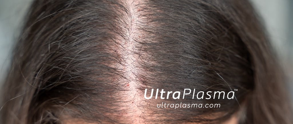 ultraplasma.com ultra plasma ultra plasma hair loss thin hair growth activation treatment