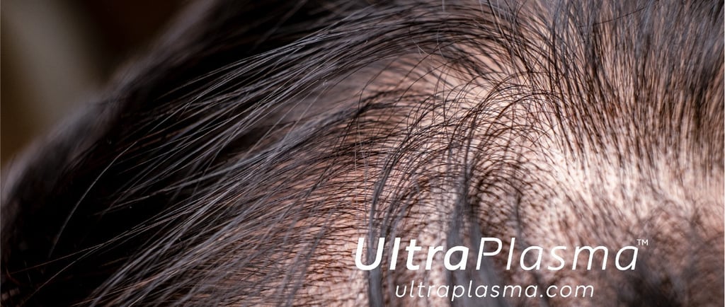 ultraplasma.com ultra plasma ultra plasma hair loss thin hair growth activation treatment
