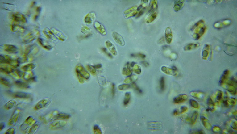 Microscopic view of green diatom algae cells clustered in a liquid sample.