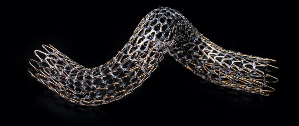 Vascular surgery artery stent by dr omar hamdallah