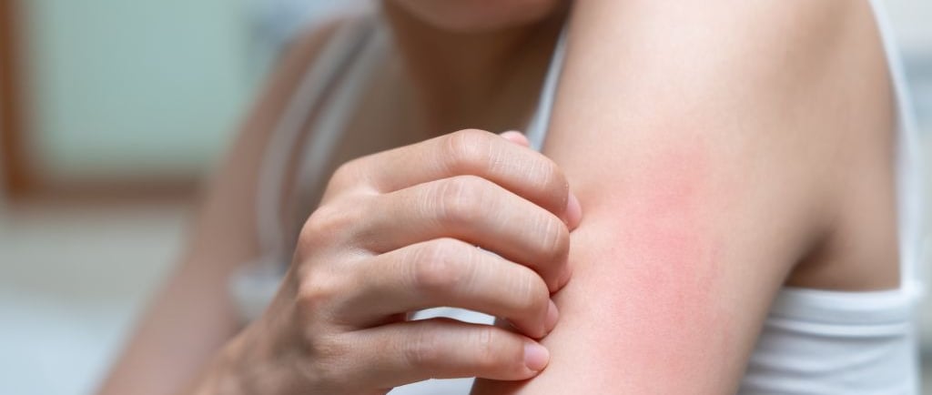 a woman scratching her arm to ease itchiness