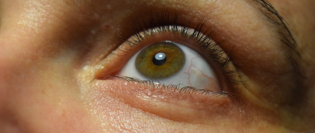 Green eye