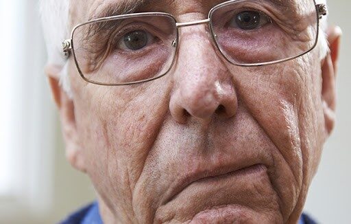 El Cannabis medicinal es efectivo para tratar la parálisis de Bell