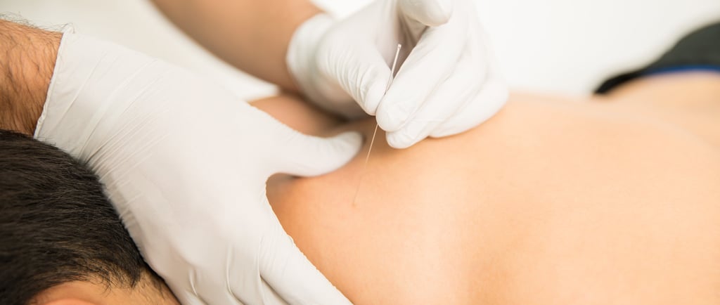 shoulder pain acupuncturist