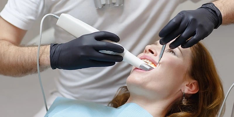 El uso del escáner dental ha revolucionado la odontología, conoce los beneficios del scan intraoral
