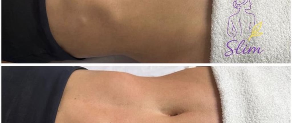 Drenagem linfática em São José do Rio Preto