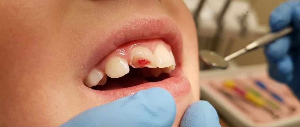 Trauma dental