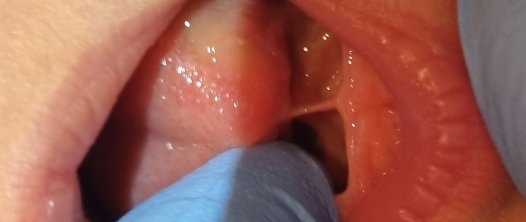 Baby with tongue-tie