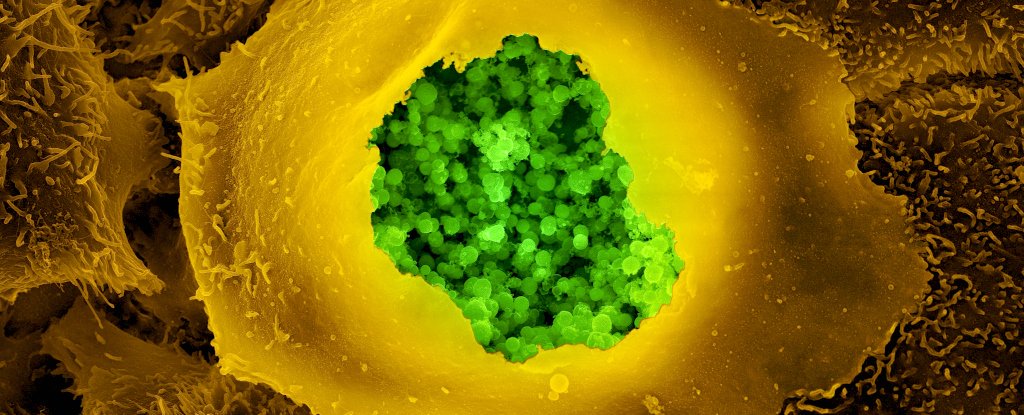 Chlamydia Pneumoniae infecting a human cells and damaging mitochondrial activity.