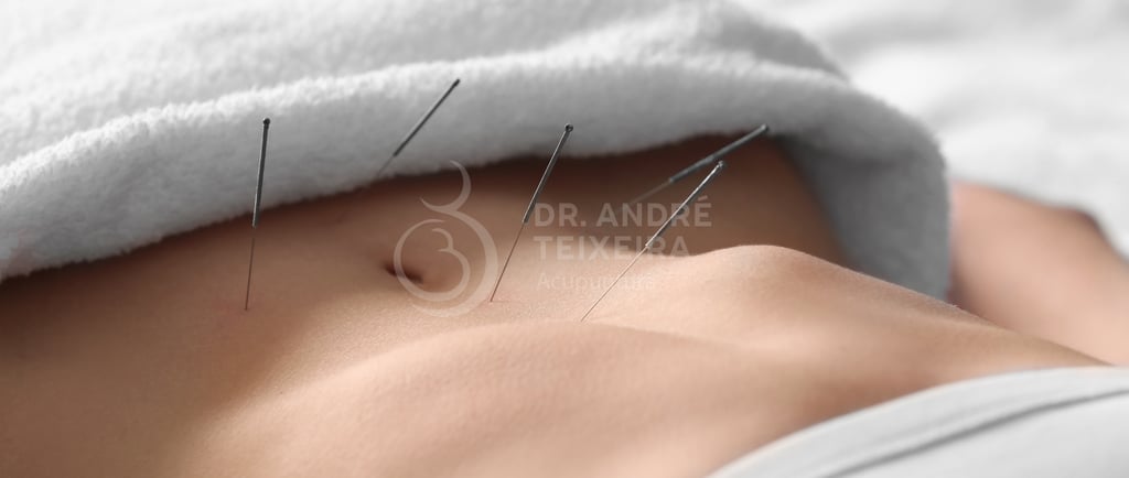 uma mulher com agulhas de acupuntura em barriga de mulher que deseja engravidar