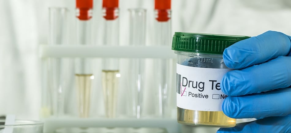 a person in a lab coat holding a bottle of urine