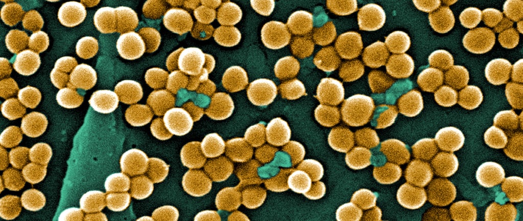 MRSA Bacteria