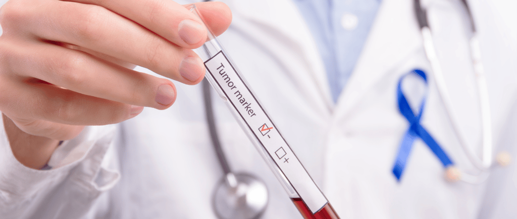 Condena por diagnóstico tardío de leucemia