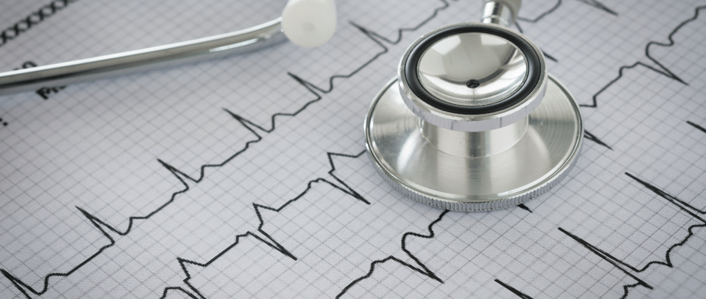 cardiología -negligencia médica en infarto