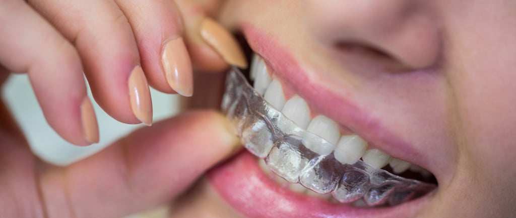 Invisalign - Studio Dentistico Dott. Pierluca Vivaldini - Gambara