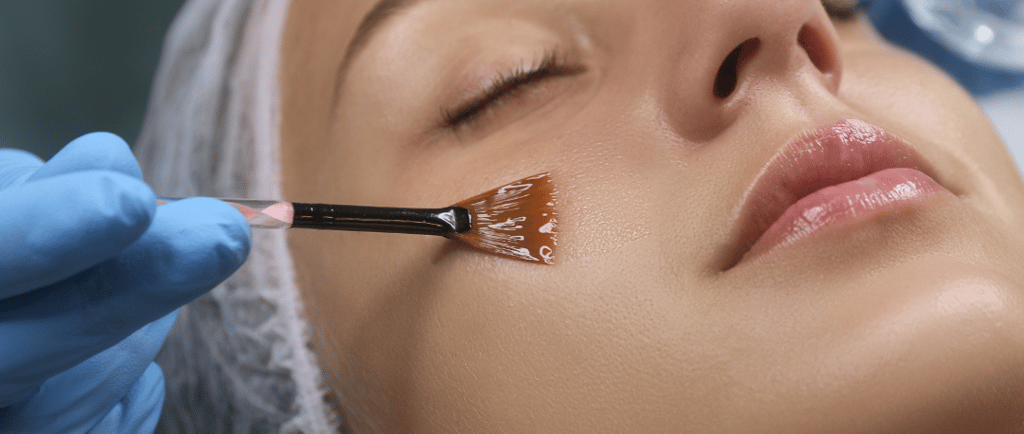 Peeling facial en Quito