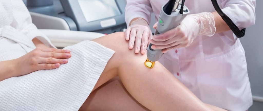 Lazer epilasyon sonrası dökülmeye başlayan tüyleri gösteren yakın plan kadın kolu