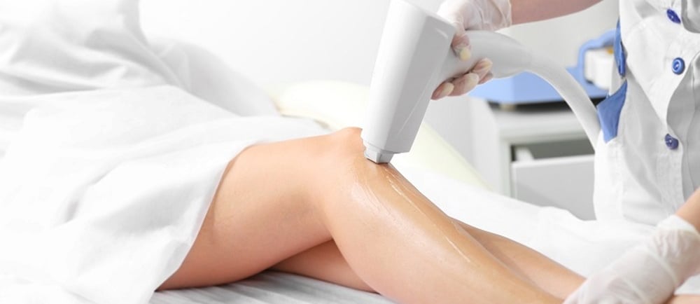 Diode lazer cihazı ile epilasyon işlemi yapılan modern klinik ortamı