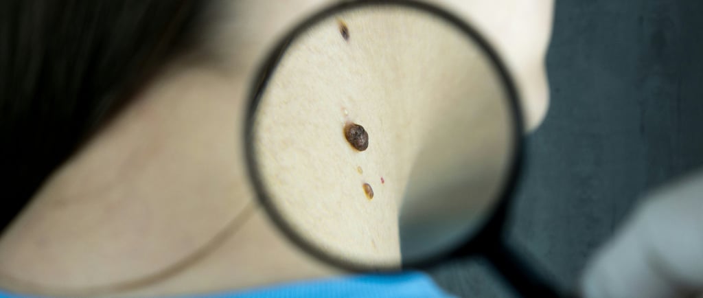 Aplicações Reais da Inteligência Artificial na Dermatologia