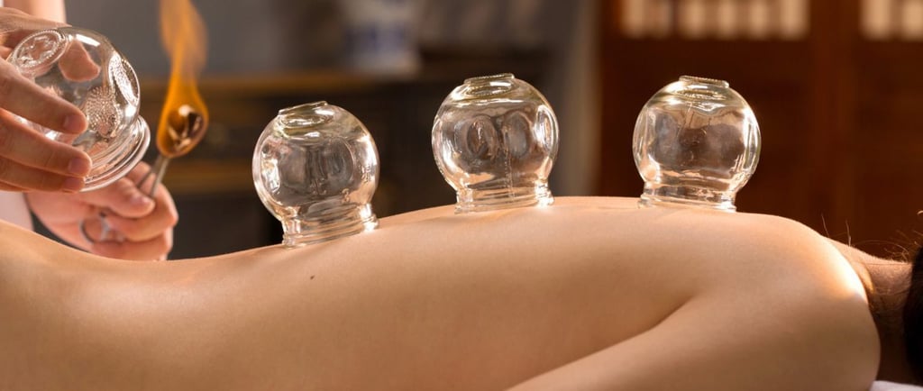 A practitioner performs fire cupping therapy with glass jars on a patient's back for muscle recovery.