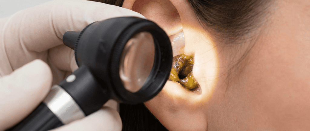 paciente con tapon de cerumen siendo revisada por otorrinolaringologo en consultorio