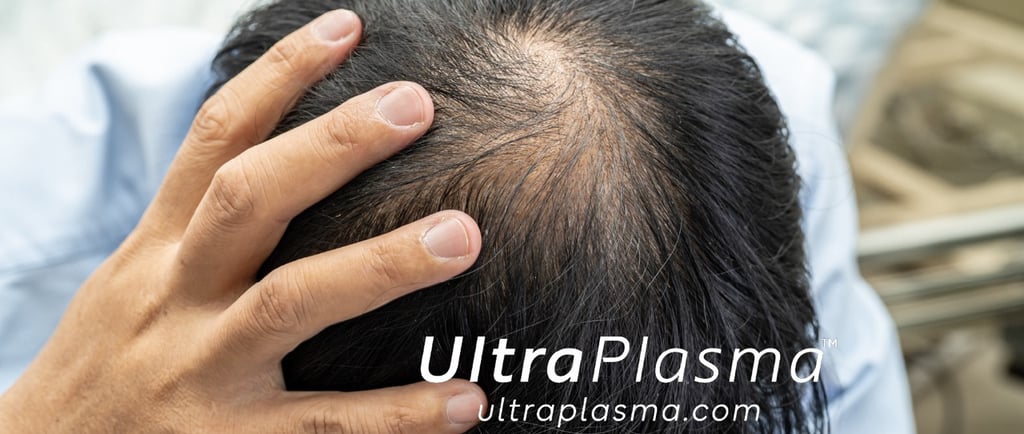 _ultra_plasma_ultra_plazma_ultra-plasma_ultra-plazma