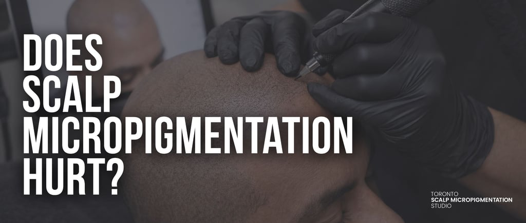 Professional scalp micropigmentation artist performing a hair tattoo procedure on a bald head.