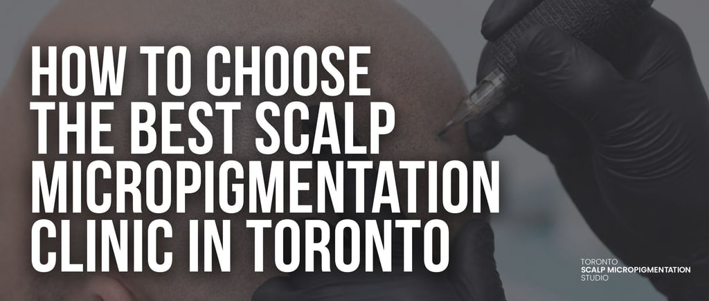 Professional performing scalp micropigmentation hair tattoo at a clinic in Toronto.