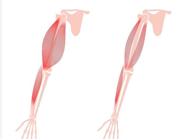 Muscular Dystrophy