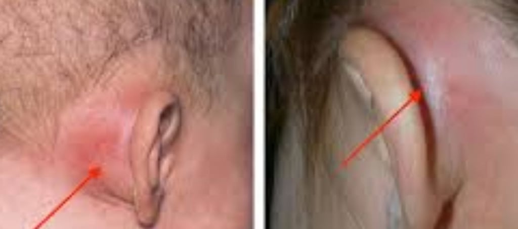 Fasting + Honey + Apitherapy = Natural Defense Against Bone Infections photo