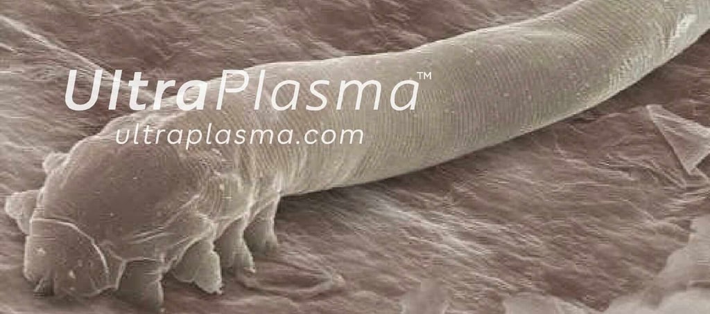 demodex_tedavi_treatment_ultra_plasma_ultra_plazma_ultra-plasma_ultra-plazma