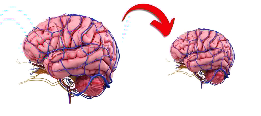 Illustration of a normal-sized brain on the left and an arrow pointing to a smaller brain.