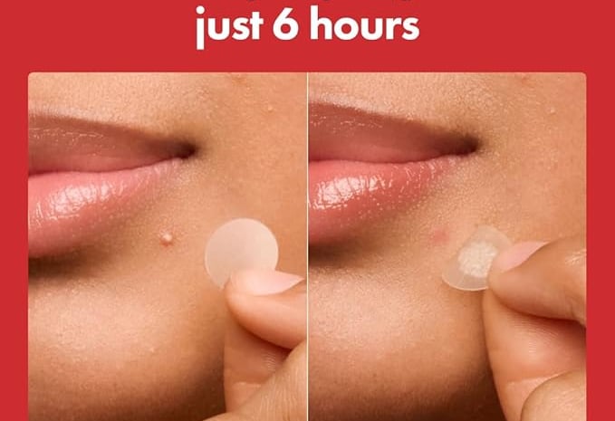 a woman with a clear plastic lens and a clear plastic lens on her lips