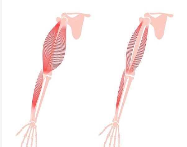 Muscular dystrophy