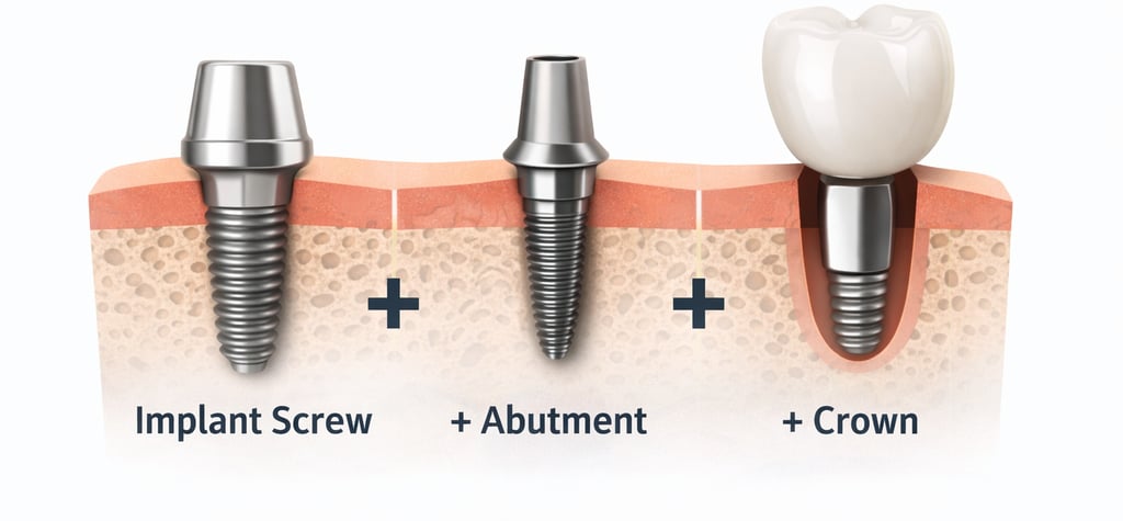 dental Implant cost 