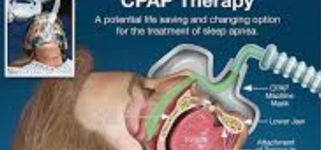 cpap العلاج