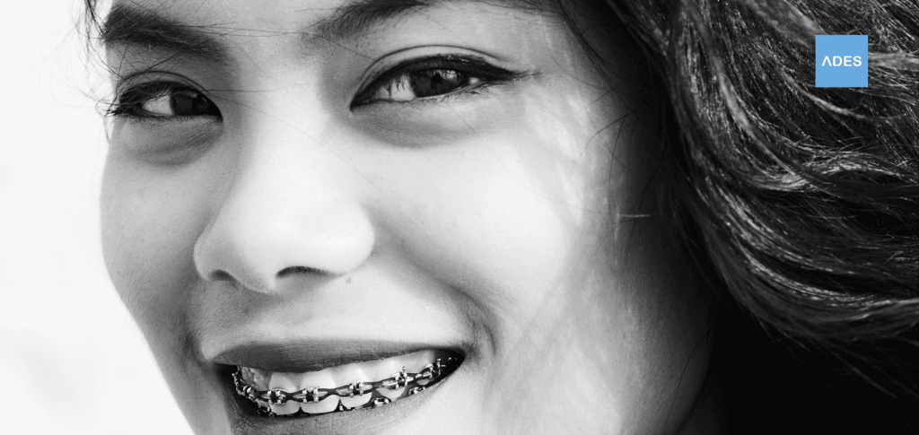 brackets badajoz