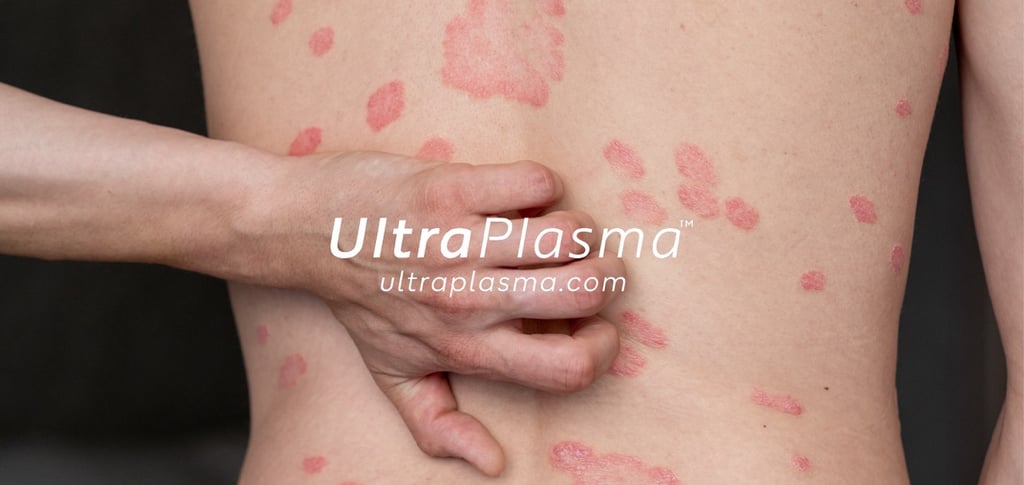 _ultra_plasma_ultra_plazma_ultra-plasma_ultra-plazma