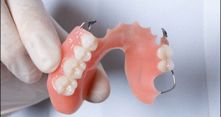 classificação de kennedy resumida prótese dentária