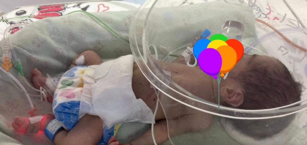 Cirugía Pediátrica. Atresia Esofágica