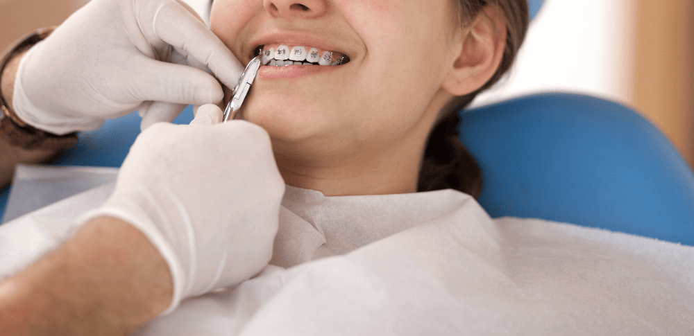 Benefits of early orthodontic treatment