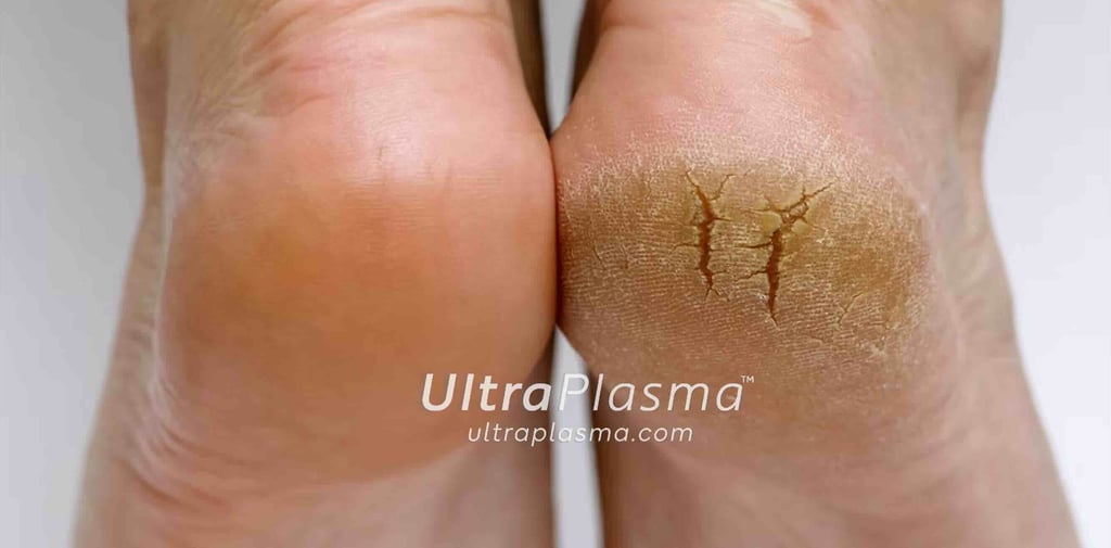 ultra_plasma_ultra_plazma_ultra-plasma_ultra-plazma