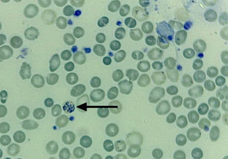 lâmina de hemograma corada para contar reticulócitos